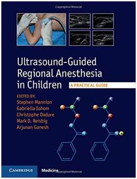 ultrasound guided regional anesthesia in children